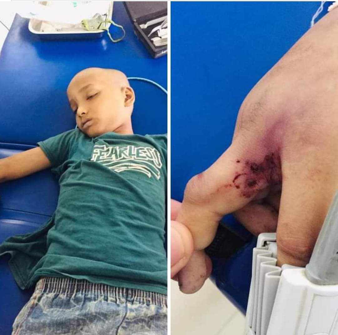 राजापुरमा सर्पको टोकाइ बाट नाबालिकको मृत्यु